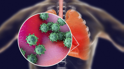 Чем опасна вирусная пневмония для населения