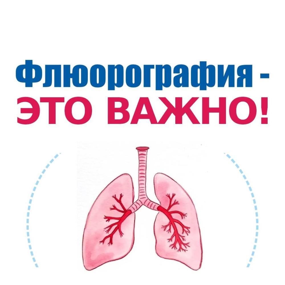 Приглашаем на флюорографию.